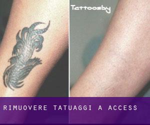 Rimuovere Tatuaggi a Access