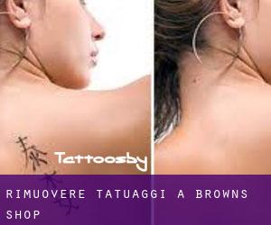 Rimuovere Tatuaggi a Browns Shop