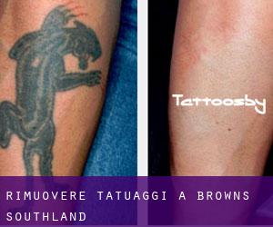 Rimuovere Tatuaggi a Browns (Southland)