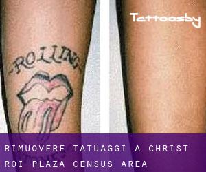 Rimuovere Tatuaggi a Christ-Roi-Plaza (census area)