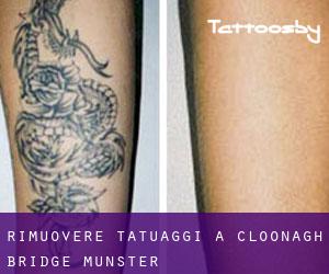 Rimuovere Tatuaggi a Cloonagh Bridge (Munster)