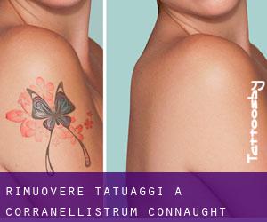 Rimuovere Tatuaggi a Corranellistrum (Connaught)