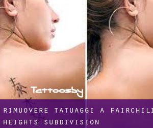 Rimuovere Tatuaggi a Fairchild Heights Subdivision