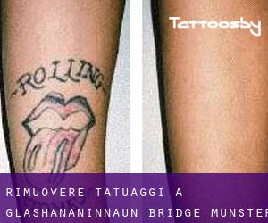 Rimuovere Tatuaggi a Glashananinnaun Bridge (Munster)