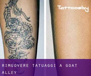 Rimuovere Tatuaggi a Goat Alley