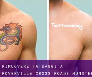 Rimuovere Tatuaggi a Roverville Cross Roads (Munster)