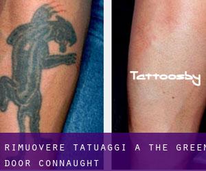 Rimuovere Tatuaggi a The Green Door (Connaught)